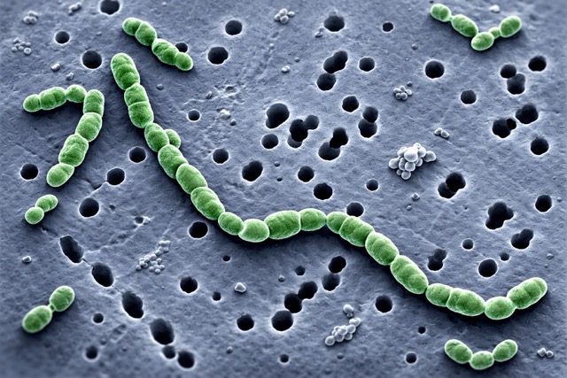cellules de Oenococcus oeni sous microscope : cette bactérie lactique est responsable de la transformation de l’acide malique en acide lactique lors de la fermentation malolactique du vin